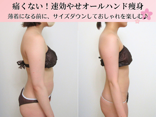 美しく痩せる痩身専門店 Reclat（リクラ）(リクラ)