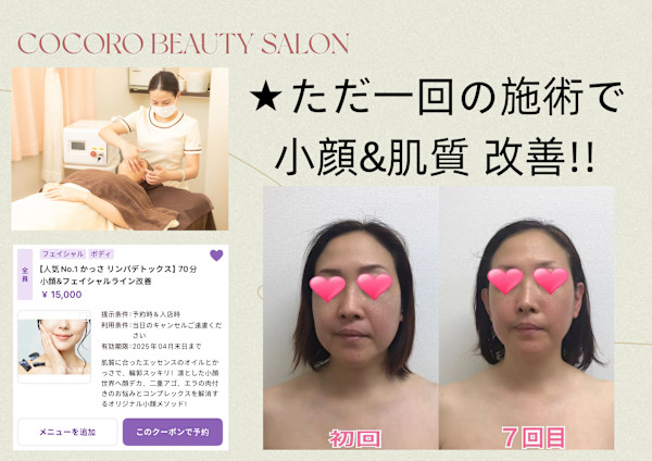 COCORO エステサロン(ココロエステサロン)