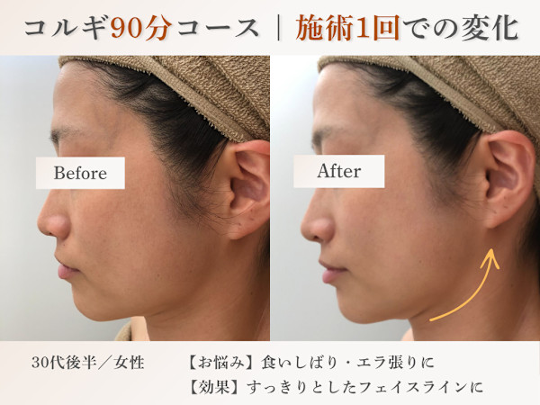 elma〜小顔コルギ/肩こり/毛穴/リンパマッサージ〜(エルマコガオコルギカタコリケアナリンパマッサージ)