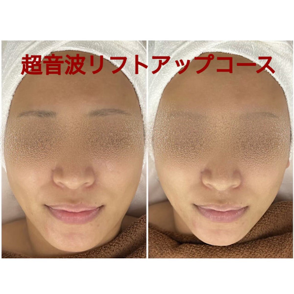 ちゅるん肌.COM 心斎橋店(チュルンハダドットコム シンサイバシテン)