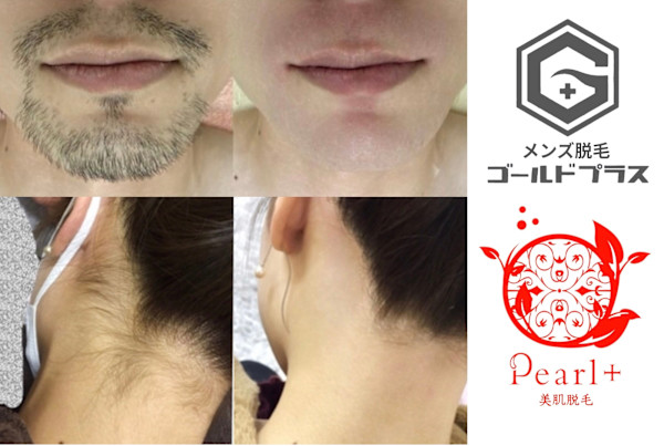 美肌脱毛＆トータルビューティー パールプラス 日田店(ビハダダツモウ トータルビューティー パールプラス ヒタテン)