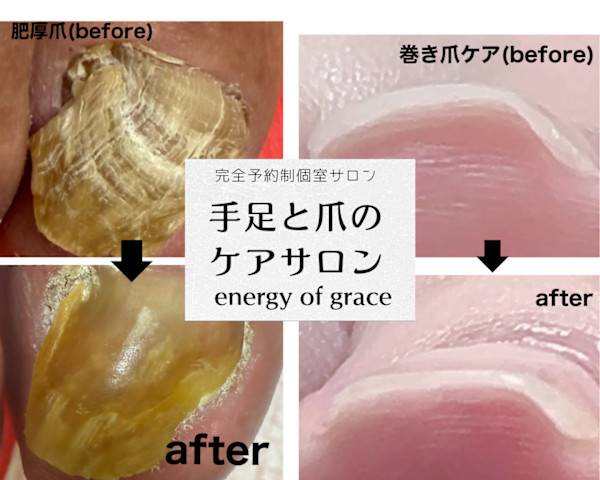 energy of grace(エナジー オブ グレース)