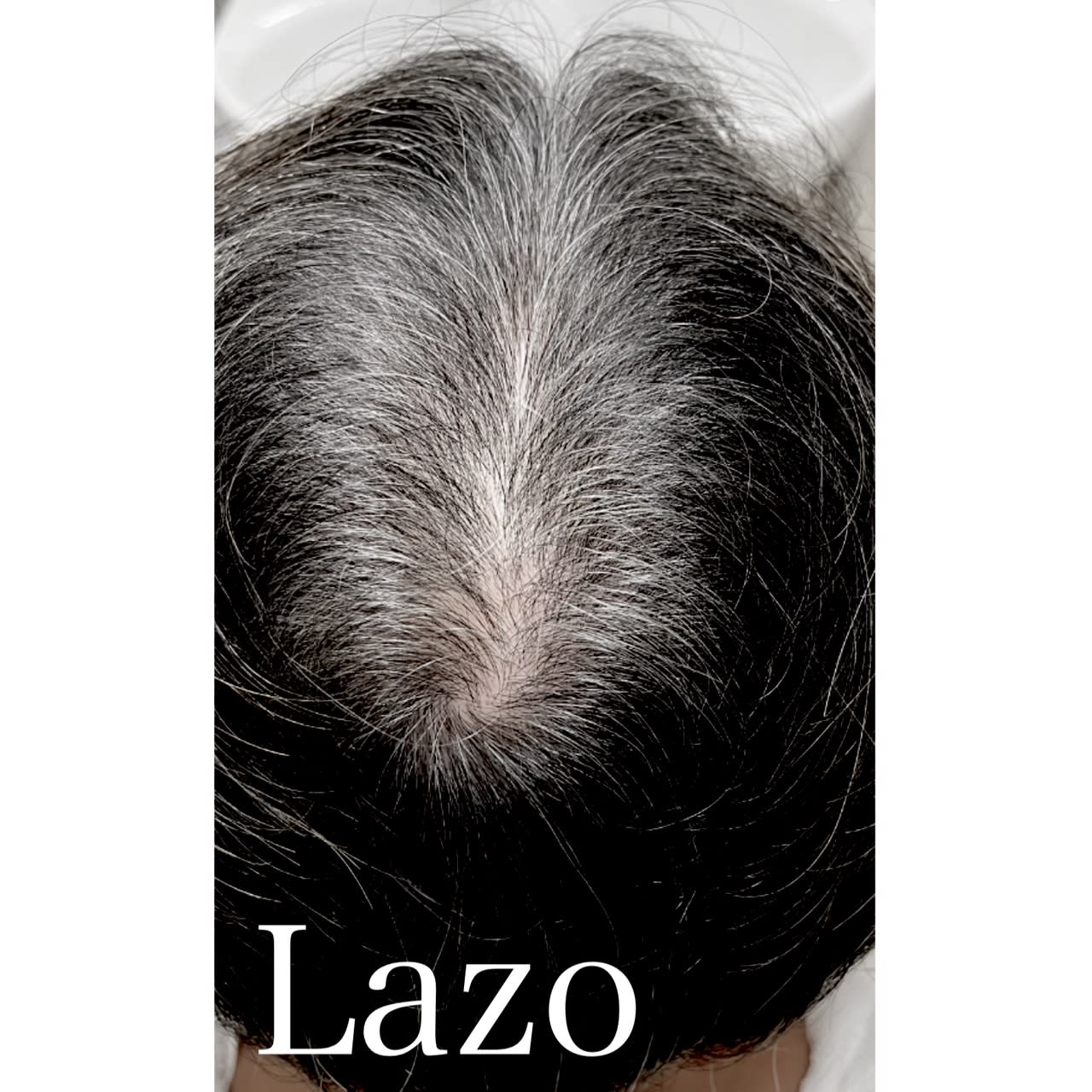 増毛エクステ/ウィッグ専門店 Lazo hair【ラソヘアー】【ゾウモウエクステ ウィッグセンモンテン ラソヘアー】のスタイル紹介。つむじ、分け目ボリュウームアップ