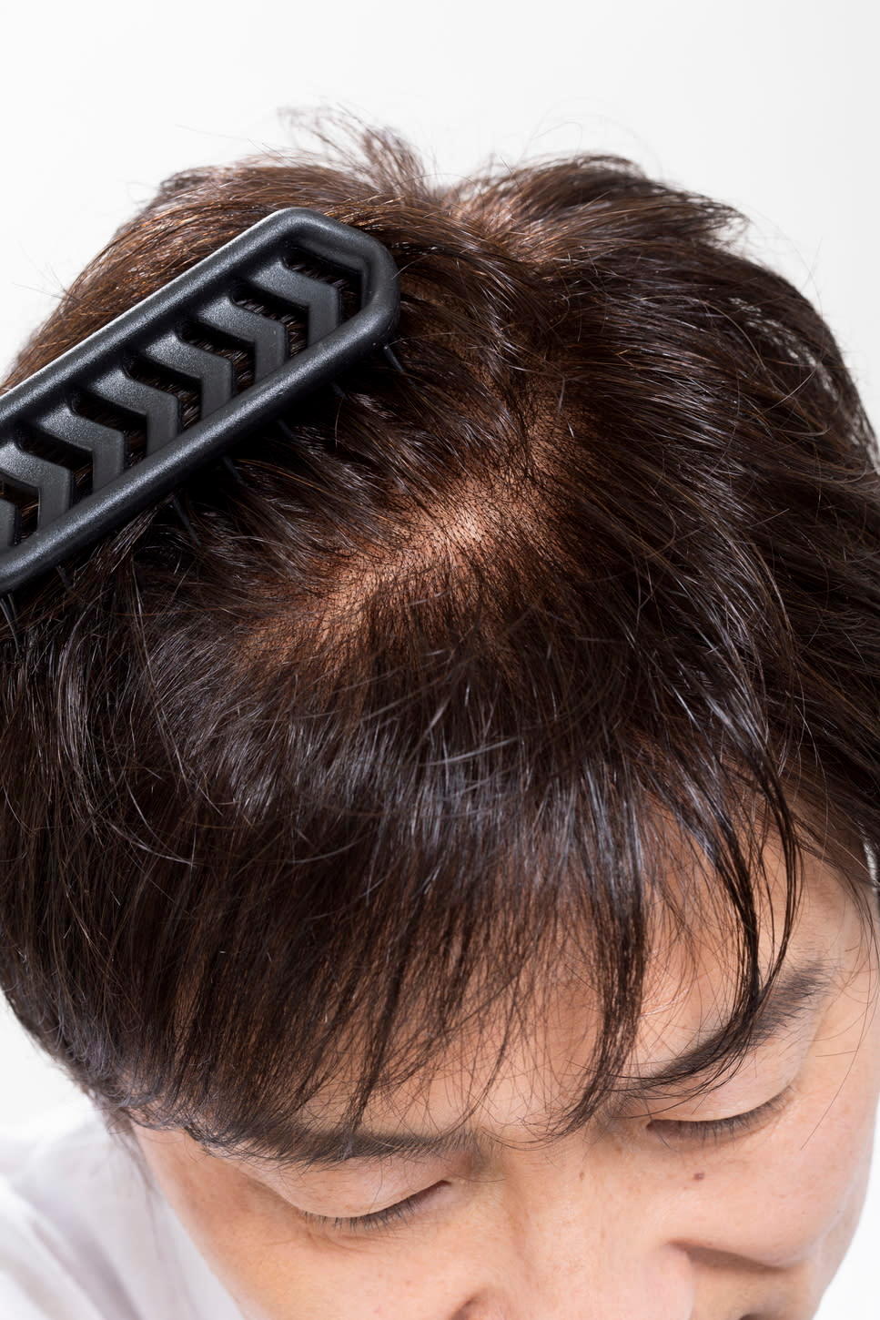 増毛エクステ/ウィッグ専門店 Lazo hair【ラソヘアー】【ゾウモウエクステ ウィッグセンモンテン ラソヘアー】のスタイル紹介。かつらセカンドオピニオン相談