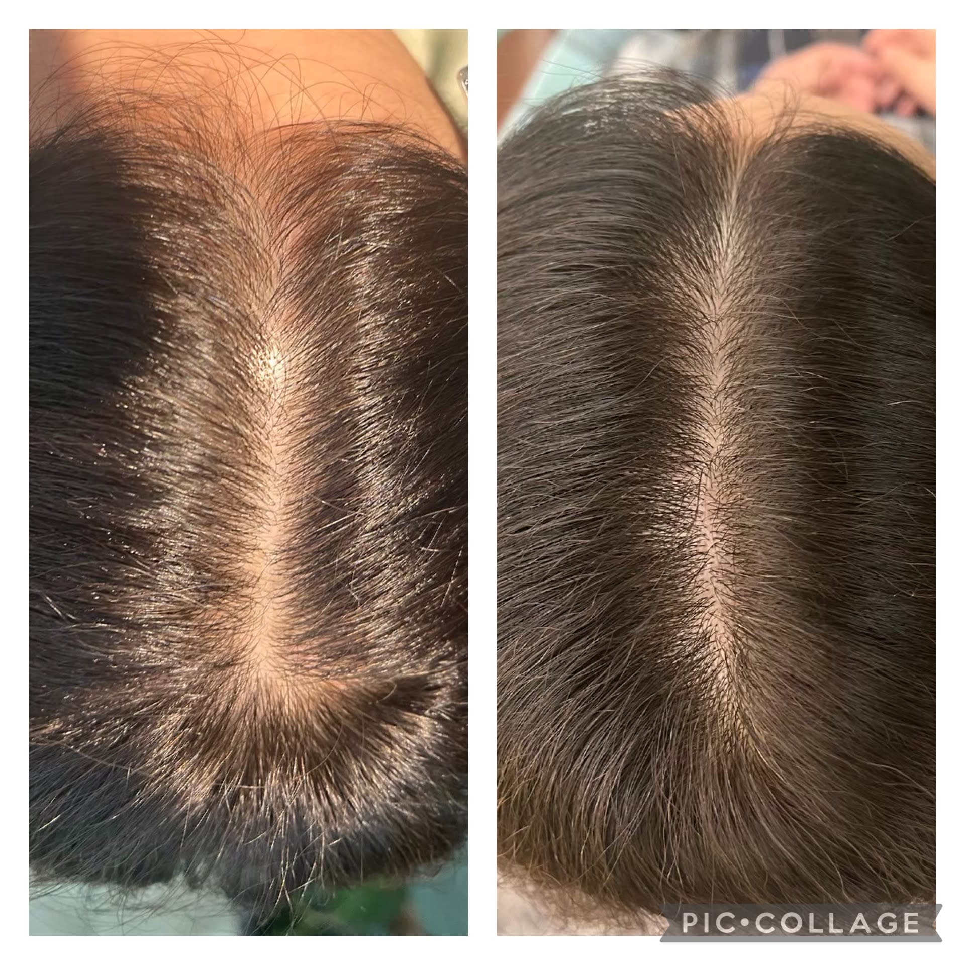 HEAD CONNECT E【ヘッドコネクトイー】のスタイル紹介。HEAD CONNECT E×スタイル