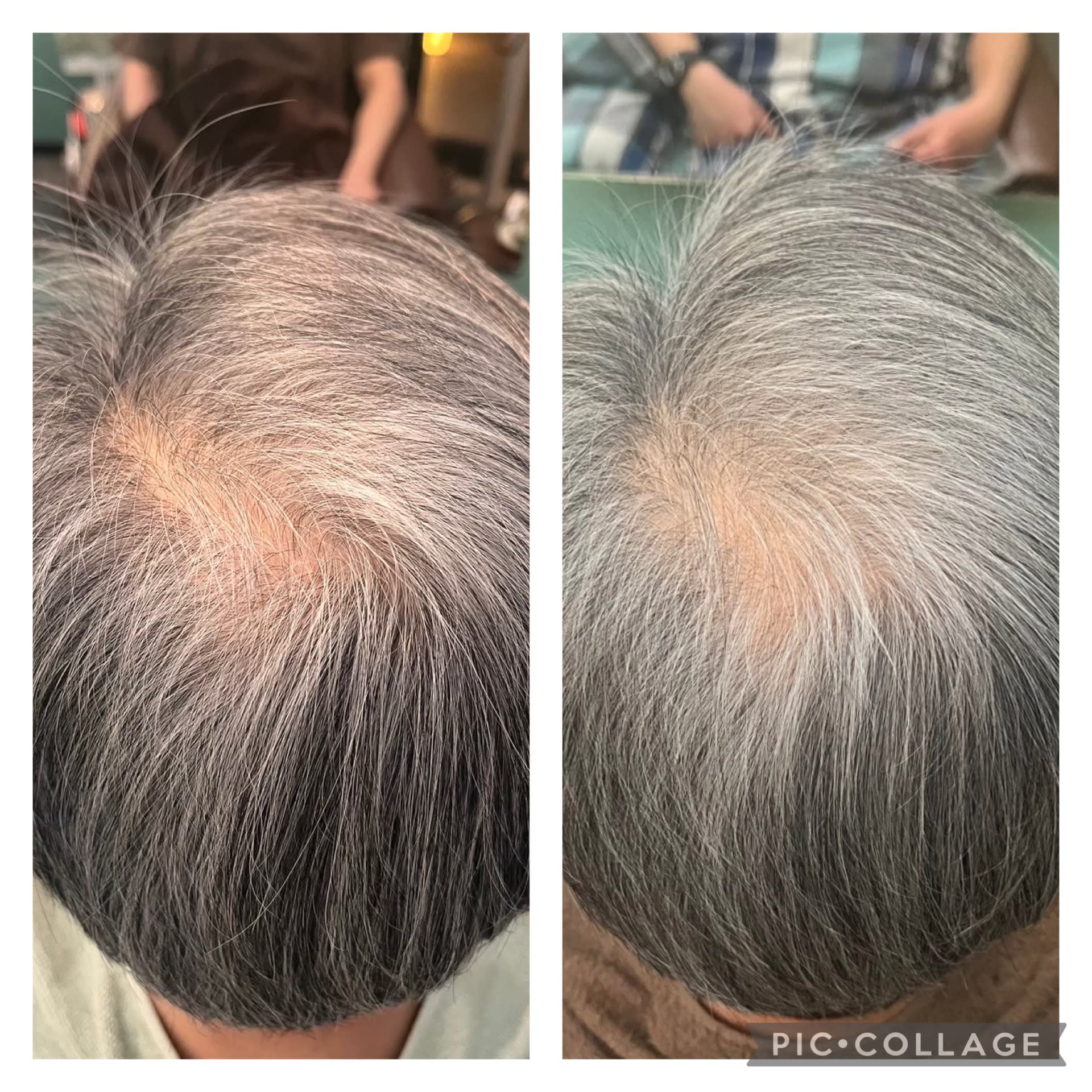 HEAD CONNECT E【ヘッドコネクトイー】のスタイル紹介。HEAD CONNECT E×スタイル