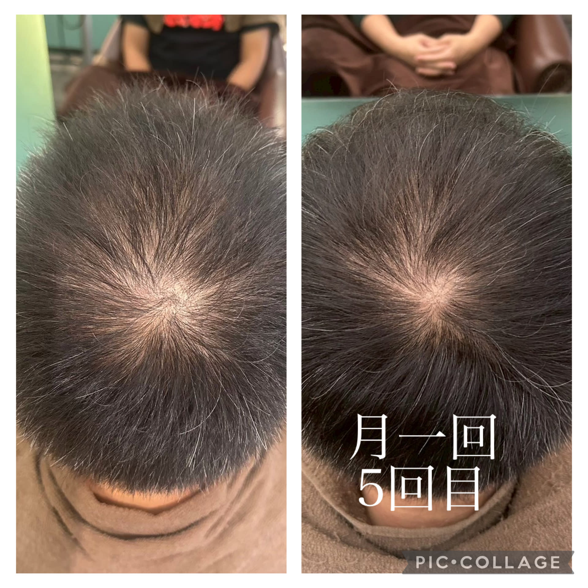 HEAD CONNECT E【ヘッドコネクトイー】のスタイル紹介。HEAD CONNECT E×スタイル