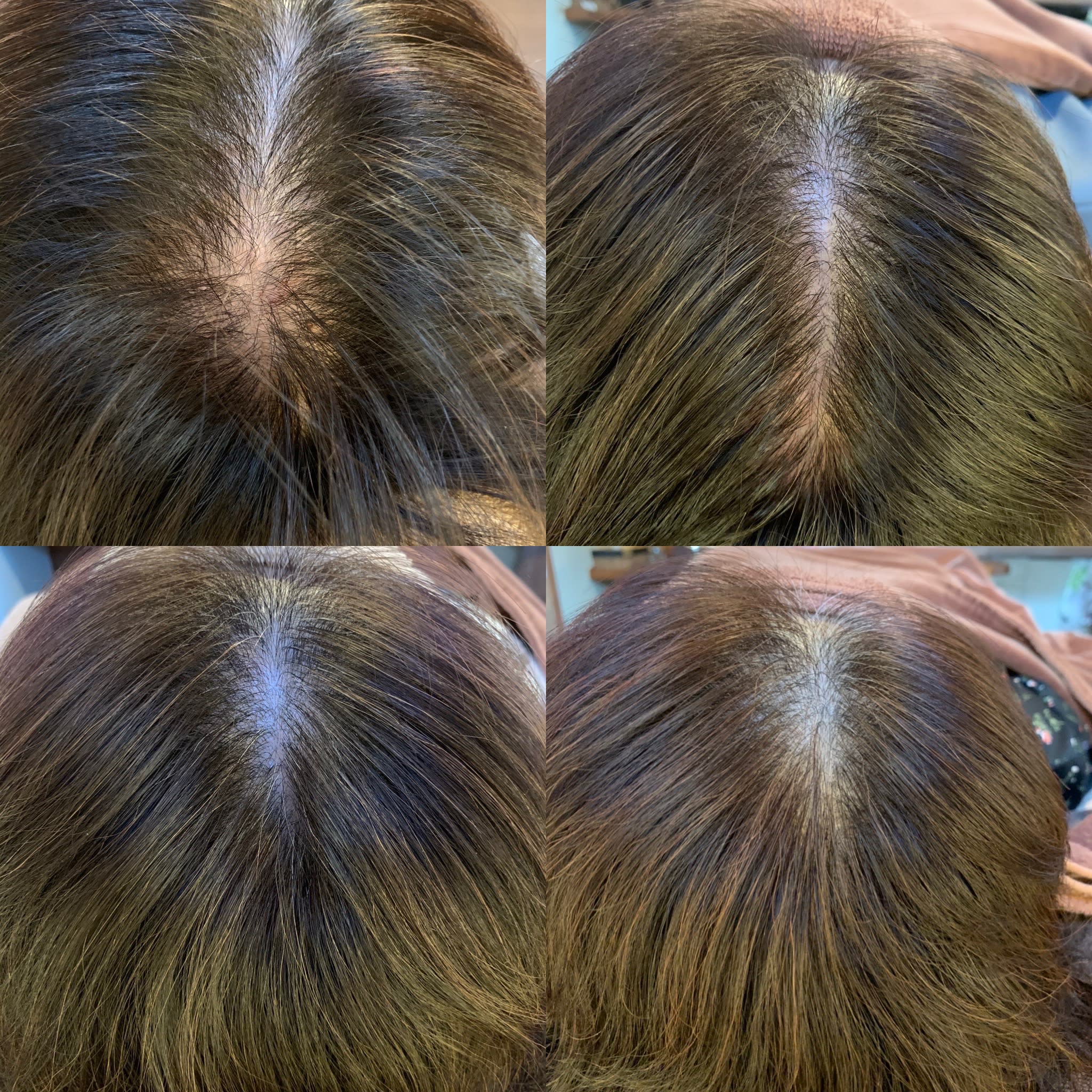 nico hair【ニコ ヘアー】のスタイル紹介。ニコヘアーオリジナル育毛メニュー