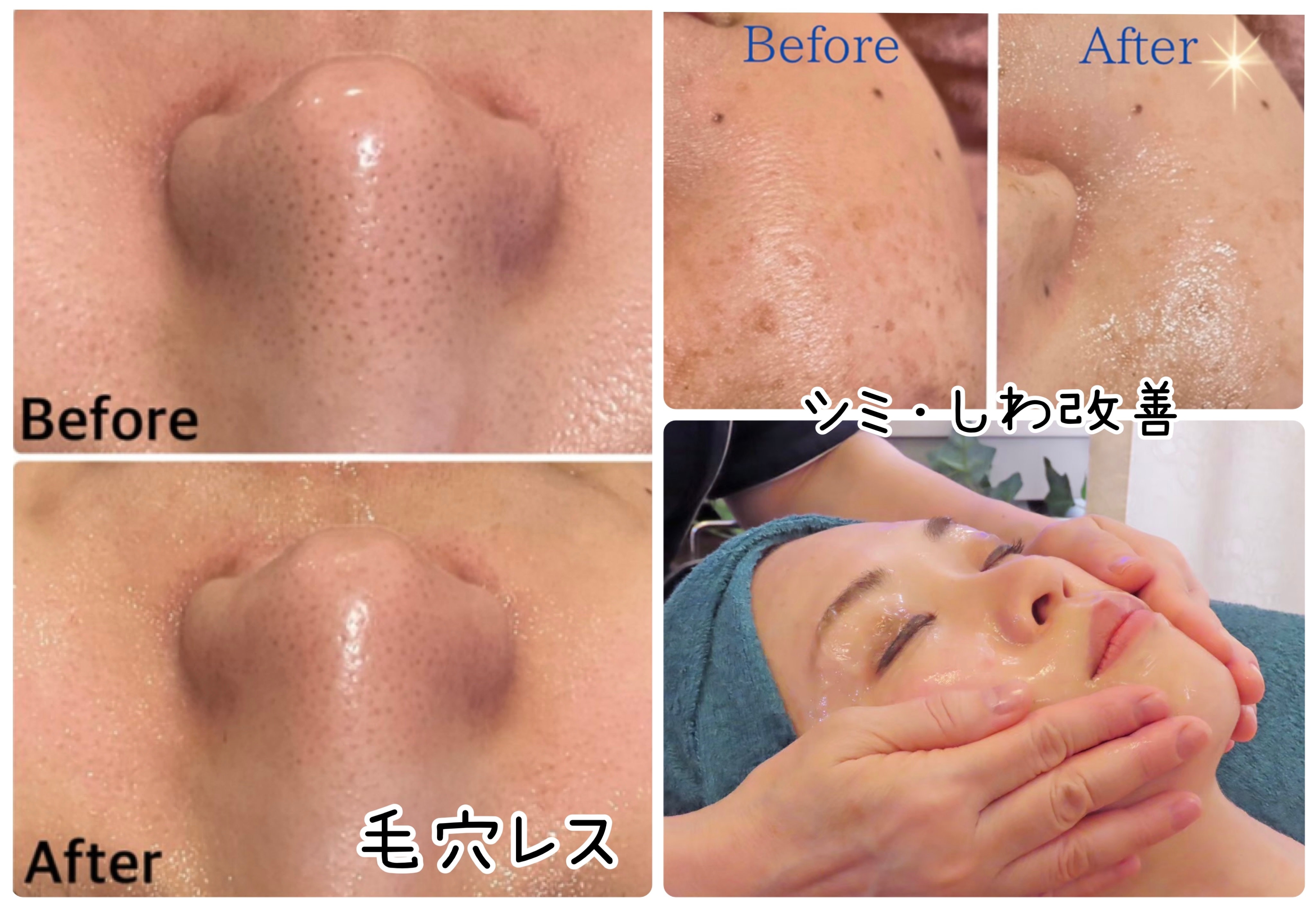 トータル美還元サロン mindエステプリミア虎ノ門店のアイキャッチ画像