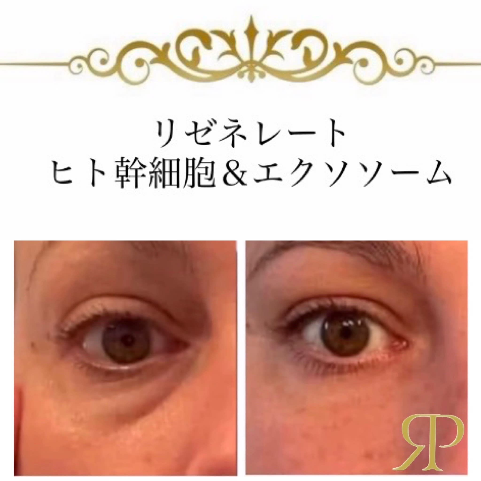 40歳からのエイジンサロン Raj Path ラージ パトゥのアイキャッチ画像