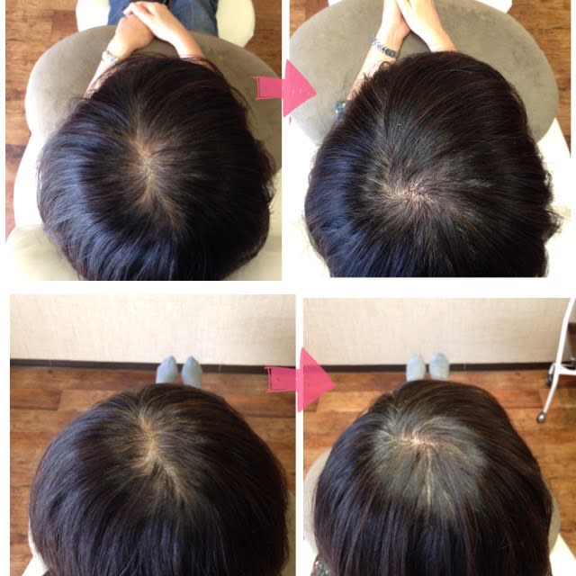 美容院 be shealing【ビヨウインビーシェアリング】のスタイル紹介。美容院 be shealing×増毛エクステ