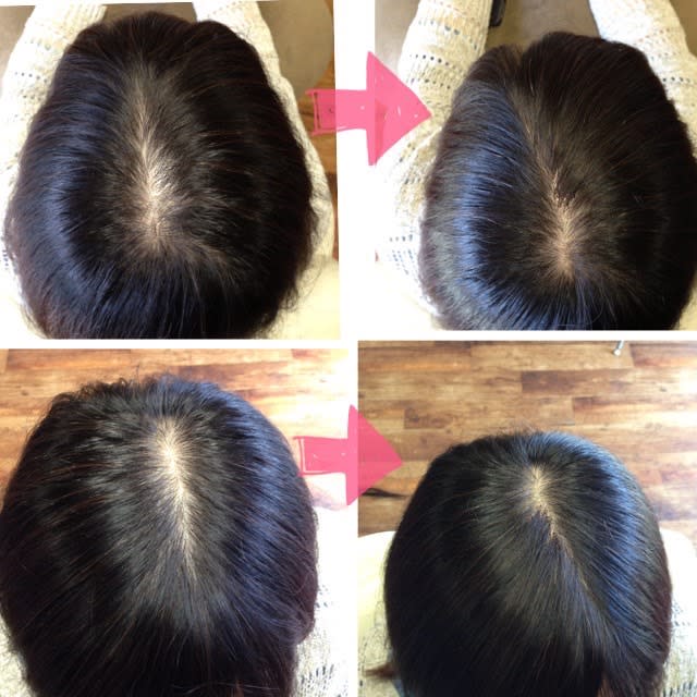 美容院 be shealing【ビヨウインビーシェアリング】のスタイル紹介。美容院 be shealing×増毛エクステ