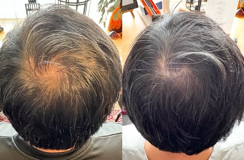 髪を育てる美養室Soil【カミヲソダテルビヨウシツ ソイル】のスタイル紹介。解頭リリース【スペシャル】（シャンプー・ブロー付）